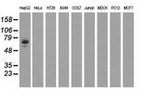 AFP Antibody in Western Blot (WB)