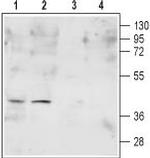 FPR2/ALX (extracellular) Antibody in Western Blot (WB)