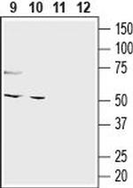 GPR120/FFAR4 (extracellular) Antibody in Western Blot (WB)