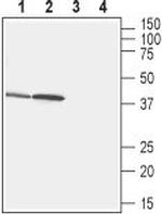 GPR43/FFAR2 Antibody in Western Blot (WB)