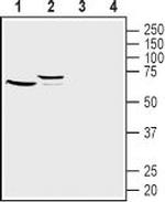 Frizzled-1 (FZD1) (extracellular) Antibody in Western Blot (WB)