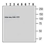 SLC19A1/RFC1 (extracellular) Antibody in Western Blot (WB)