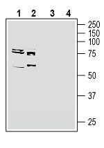 SLC19A1/RFC1 (extracellular) Antibody in Western Blot (WB)