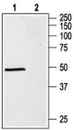 GABA(A) alpha 1 Receptor (extracellular) Antibody in Western Blot (WB)