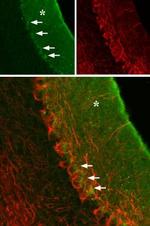 GABA(A) alpha 3 Receptor (extracellular) Antibody in Immunohistochemistry (IHC)