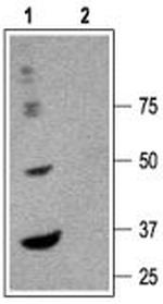 GABA(A) alpha 6 Receptor (extracellular) Antibody in Western Blot (WB)