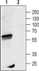 GABA(A) rho 1 Receptor (GABRR1) (extracellular) Antibody in Western Blot (WB)