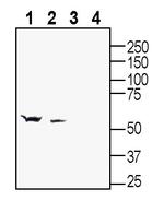 GABA(A) beta 2 Receptor Antibody in Western Blot (WB)