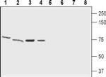 GABA(A) epsilon Receptor (GABRE) (extracellular) Antibody in Western Blot (WB)