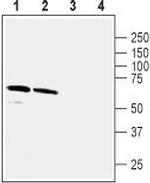 GABA(A) alpha 5 Receptor Antibody in Western Blot (WB)