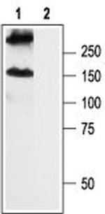 GABA(B) R2 Antibody in Western Blot (WB)