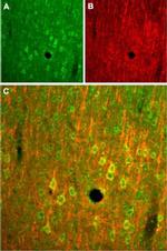 NMDAR2B (GluN2B) (extracellular) Antibody in Immunohistochemistry (Frozen) (IHC (F))