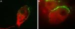 GluR1 (GluA1) (extracellular) Antibody in Immunocytochemistry (ICC/IF)