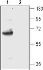 EAAT2 (GLT-1) (extracellular) Antibody in Western Blot (WB)