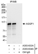 AGGF1 Antibody in Immunoprecipitation (IP)