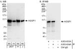 AGGF1 Antibody in Western Blot (WB)