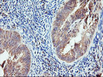 AGPAT5 Antibody in Immunohistochemistry (Paraffin) (IHC (P))