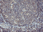 AGPAT5 Antibody in Immunohistochemistry (Paraffin) (IHC (P))