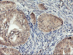 AGPAT5 Antibody in Immunohistochemistry (Paraffin) (IHC (P))