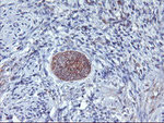 AGPAT5 Antibody in Immunohistochemistry (Paraffin) (IHC (P))