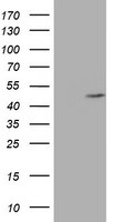 AGPAT5 Antibody in Western Blot (WB)