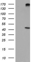 AGPAT5 Antibody in Western Blot (WB)