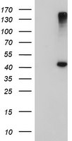 AGPAT5 Antibody in Western Blot (WB)