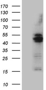 AGPAT9 Antibody in Western Blot (WB)