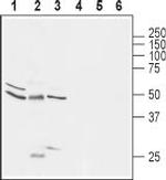 Glycine Receptor alpha 1 Antibody in Western Blot (WB)
