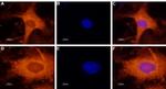 GALR1 Antibody in Immunocytochemistry (ICC/IF)