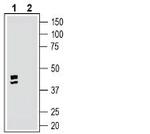 GPR35 (extracellular) Antibody in Western Blot (WB)