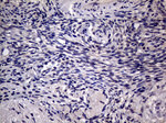 AGR2 Antibody in Immunohistochemistry (Paraffin) (IHC (P))