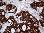 AGR2 Antibody in Immunohistochemistry (Paraffin) (IHC (P))