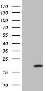 AGR2 Antibody in Western Blot (WB)