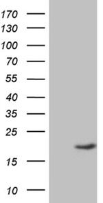 AGR2 Antibody in Western Blot (WB)