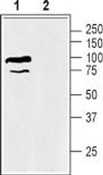 BGT-1 (SLC6A12) Antibody in Western Blot (WB)