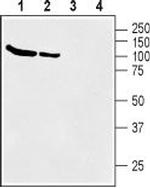 BGT-1 (SLC6A12) Antibody in Western Blot (WB)