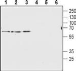 Vesicular GABA Transporter (VGAT) Antibody in Western Blot (WB)