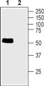 Taurine Transporter (SLC6A6) Antibody in Western Blot (WB)