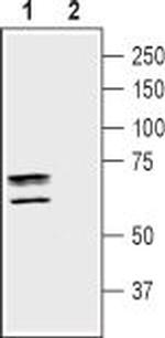 Taurine Transporter (SLC6A6) Antibody in Western Blot (WB)