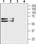 Taurine Transporter (SLC6A6) Antibody in Western Blot (WB)