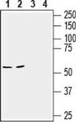 SLC6A14 (extracellular) Antibody in Western Blot (WB)