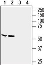 SLC6A14 (extracellular) Antibody in Western Blot (WB)