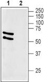 GLUT2 (SLC2A2) Antibody in Western Blot (WB)