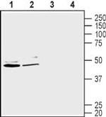 GLUT2 (SLC2A2) Antibody in Western Blot (WB)