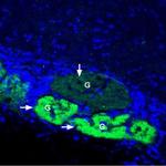 GLUT4 Antibody in Immunohistochemistry (Frozen) (IHC (F))