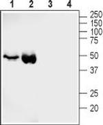 GLUT4 Antibody in Western Blot (WB)