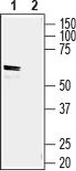 GLUT5 (SLC2A5) Antibody in Western Blot (WB)