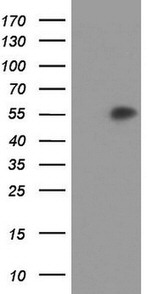 AGT Antibody in Western Blot (WB)