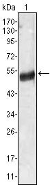 Angiotensinogen Antibody in Western Blot (WB)